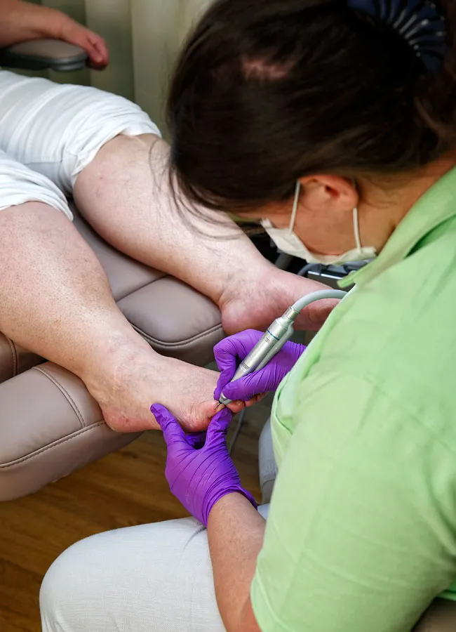 Podologikum Mauritz - Behandlung Schritt 3