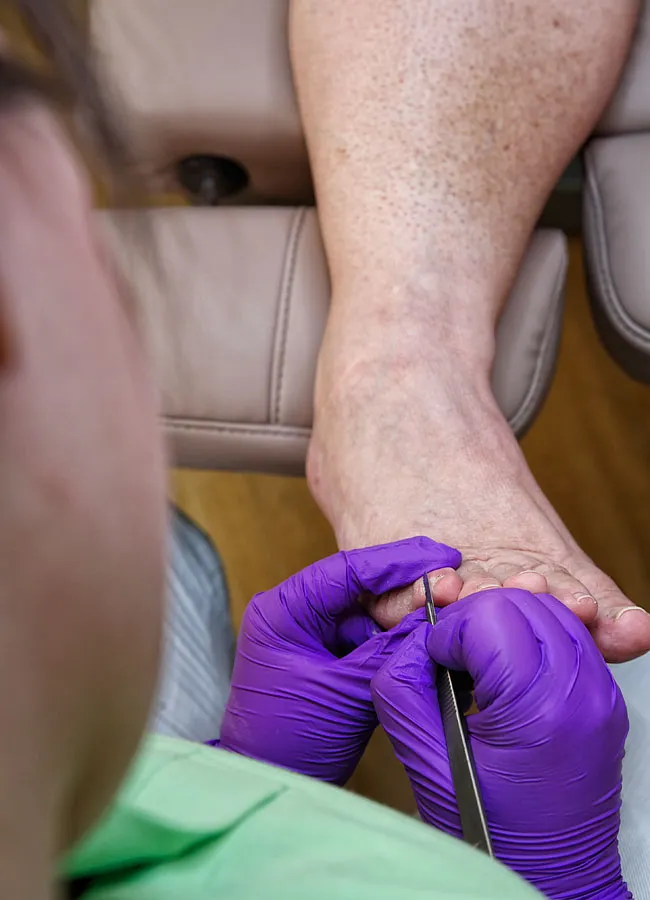 Podologikum Mauritz - Behandlung Schritt 4