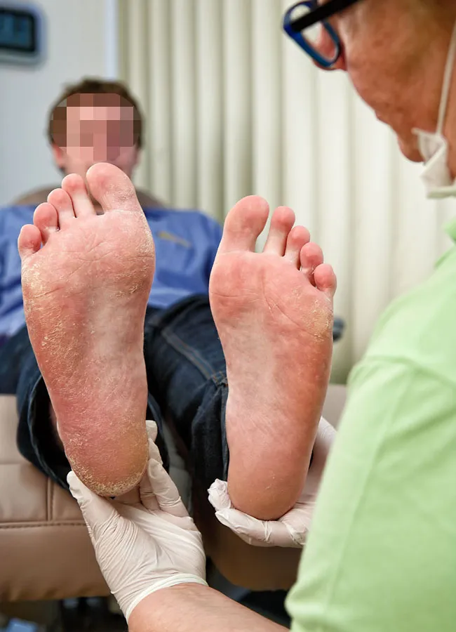 Podologikum Mauritz - Behandlung Schritt 1